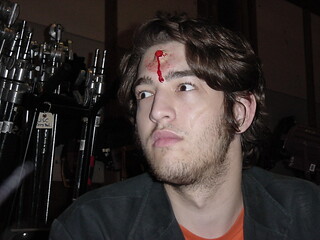 Bullet wound head.jpg